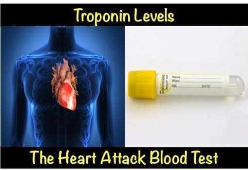 Troponin Trompers fundraising page