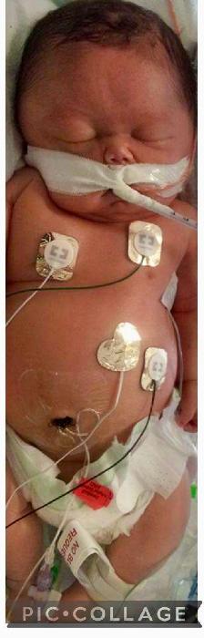 Khera's fundraising page