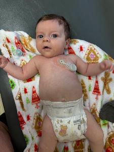 Pulse Patrol fundraising page