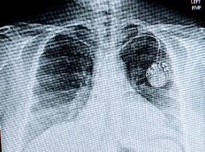 Kirsten's fundraising page