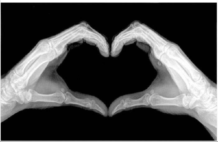 THE GLOWING HEARTS fundraising page