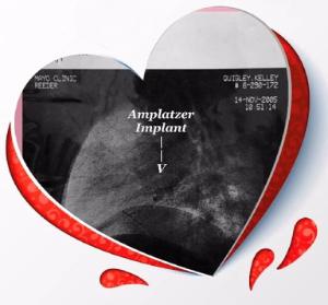 Kelley's fundraising page