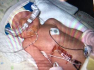 Addison's fundraising page